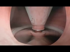 1 - 45t/H Vertical VRM Cement Mill สำหรับการบดวัตถุดิบ